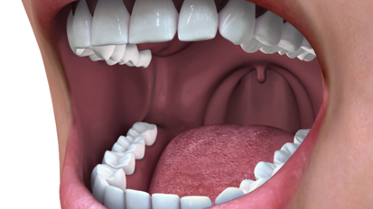 Oral Systemic Health
