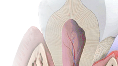 Dentin Hypersensitivity; Current Concepts in the Management of a Common Problem