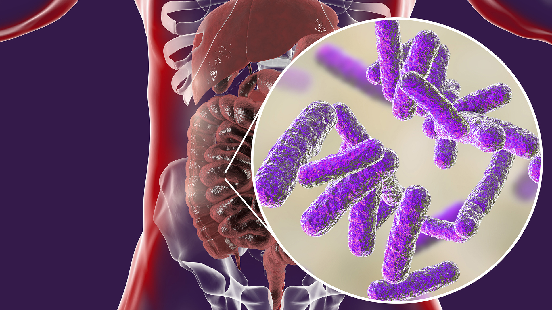 GUT HEALTH: THE GOOD THE BAD & THE UGLY