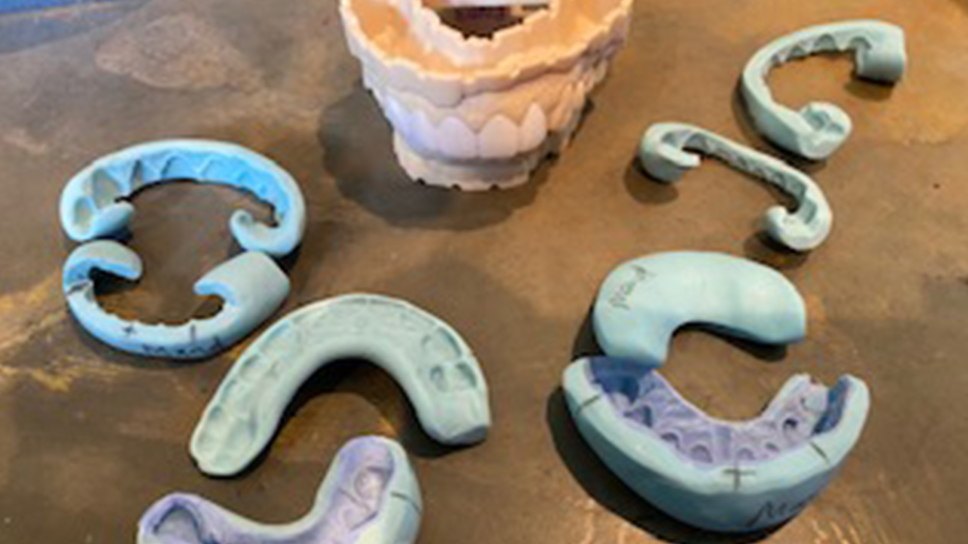 Esthetic Dentistry: Simple Tips and Tricks Using Teamwork Approach