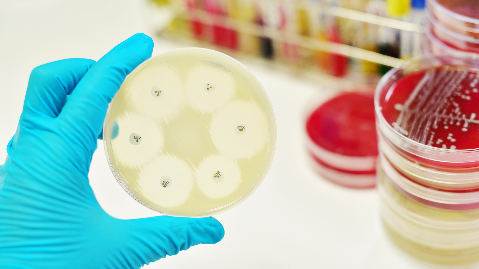 Update on Antimicrobial Resistance and the COVID-19 Pandemic